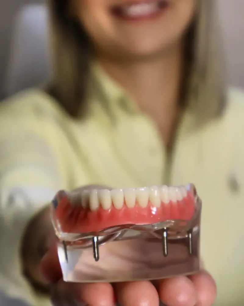 Modelo de prótese protocolo, com a arcada de dentes presa a quatro implantes, apoiado na palma da mão