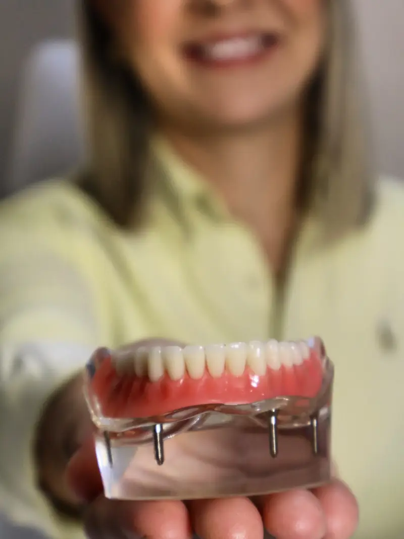 Mão segurando uma prótese protocolo, a arcada fixa que é presa sobre implantes